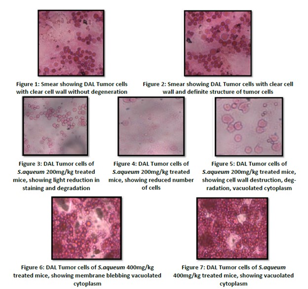 DAL Tumor cells of S.aqueum