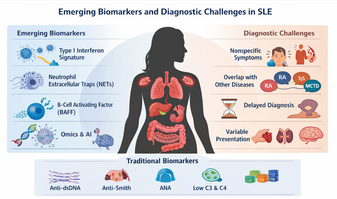 Emerging biomarkers and diagnostic challenges in systemic lupus erythematosus